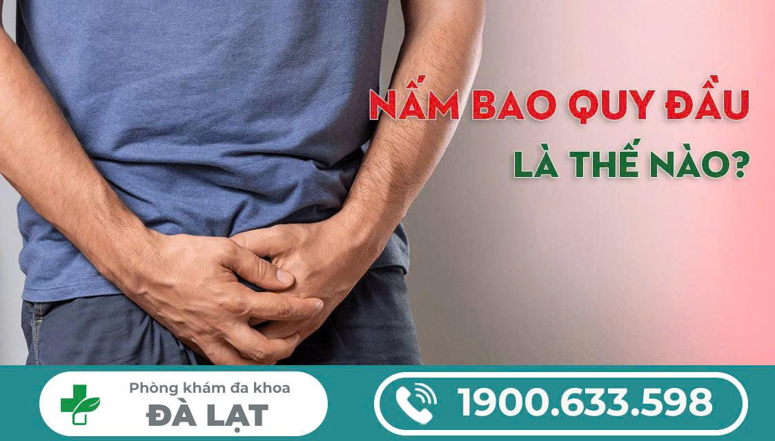 Hình ảnh minh họa